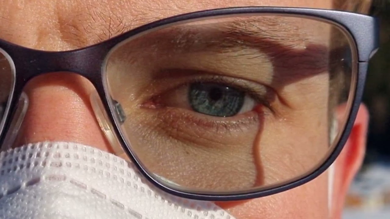 Gold-based passive heating for eyewear