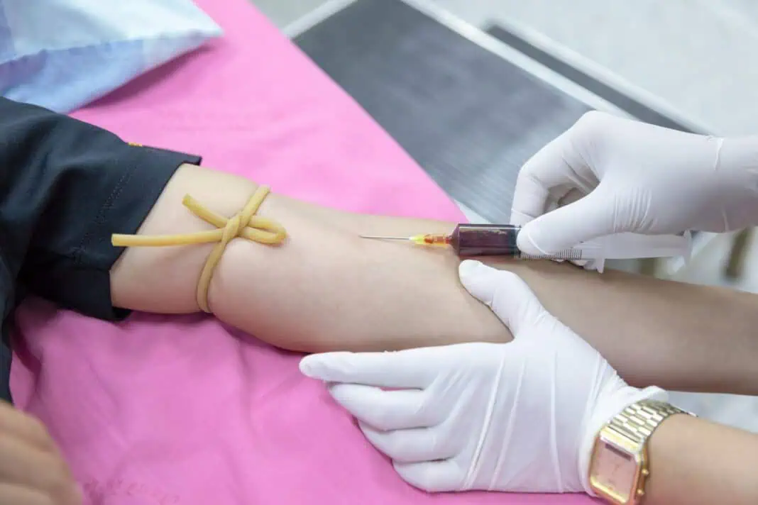 os tipos de sangue que podem aumentar o risco de demência