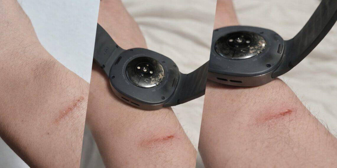 Galaxy Watch 8 a provocar queimaduras? O despertar doloroso