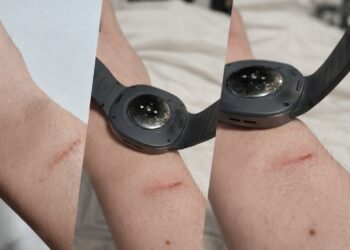 Galaxy Watch 8 a provocar queimaduras? O despertar doloroso