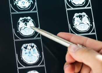 Inteligência Artificial pode substituir os radiologistas em breve